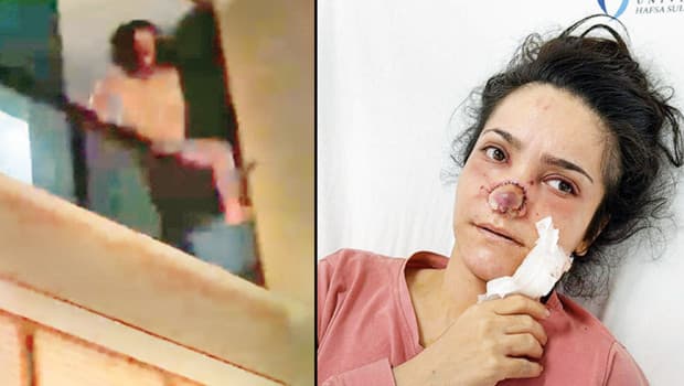 Eşinin burnunu koparan kadın: İmran Güler yaşadıklarını anlattı