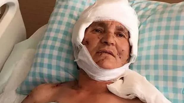 Yargıtay'dan köpek saldırısı kararı: Malul kalan kadına 637 bin lira tazminat ödenecek