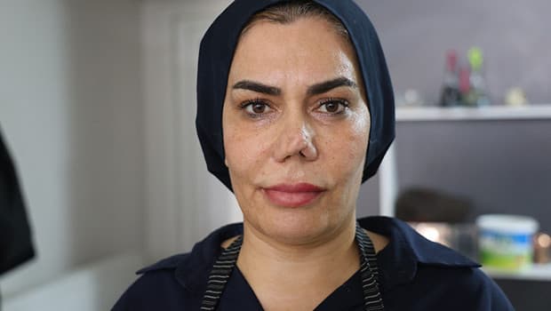 Burnunu düzeltmek isterken 4 ameliyatla hayatı kararan kadın doktora dava açtı