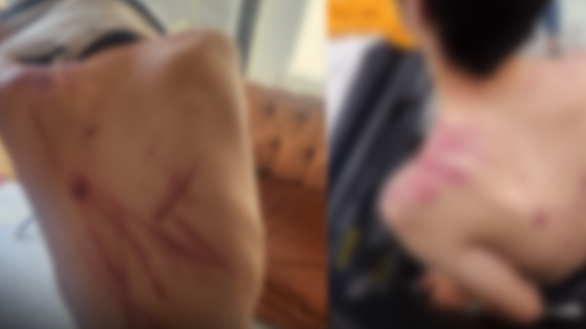 Valilik 'hafif yaralandı' ifade etti: Rehabilitasyon merkezinde korkunç işkence